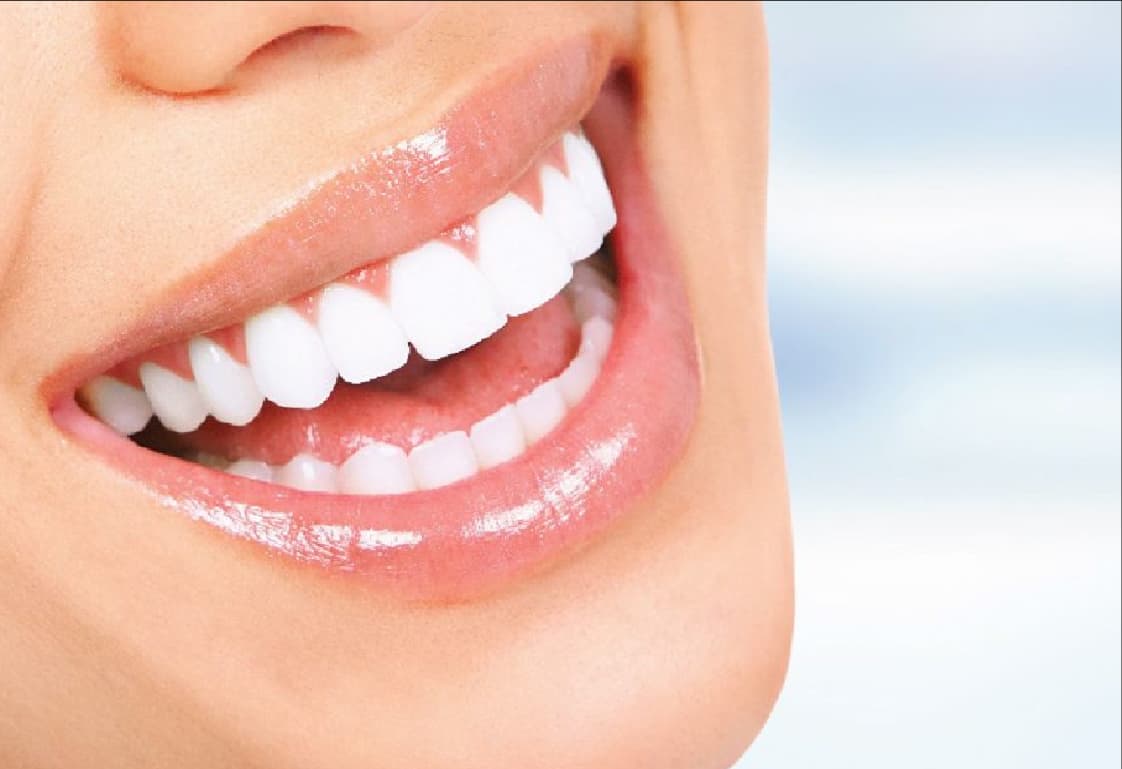 Branqueamento dentário em Odivelas: é seguro e vale a pena?